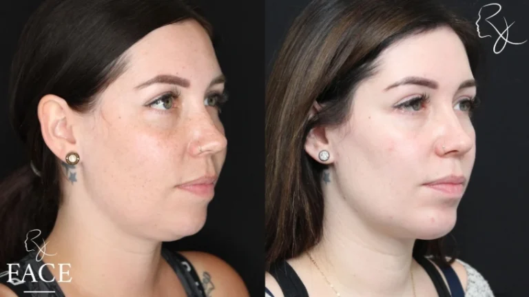 chinAugmentation1-right