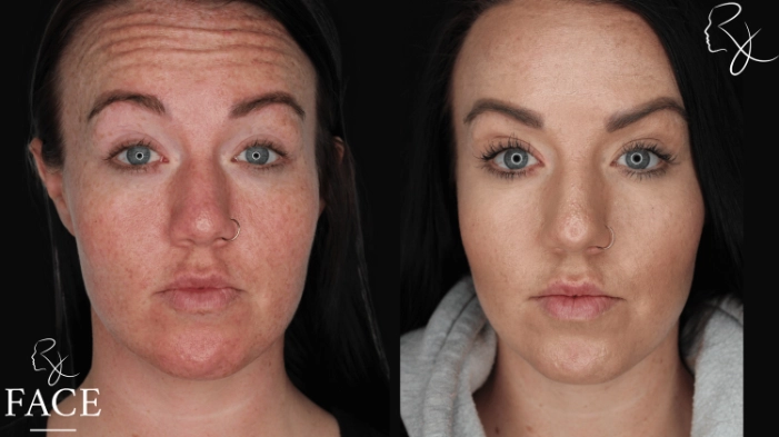 neuromodulators1-forward