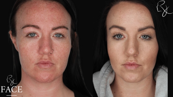 neuromodulators1-forward2