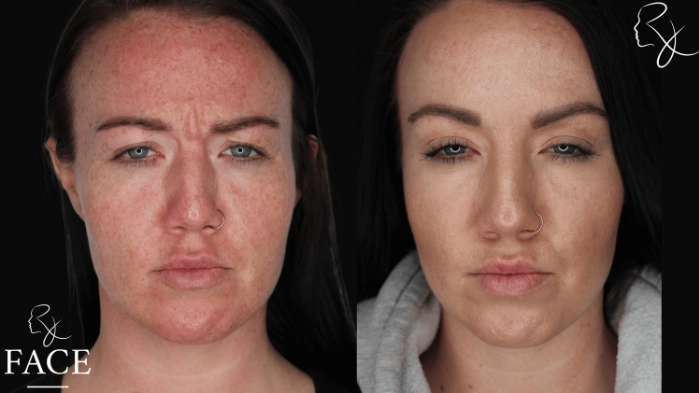 neuromodulators1-forward3